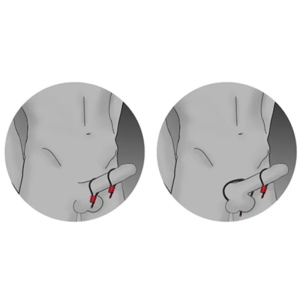 PRESTIGE ELECTRA LOOPS VERSTELLBARE COCKRINGE ROT VON ELECTRASTIM