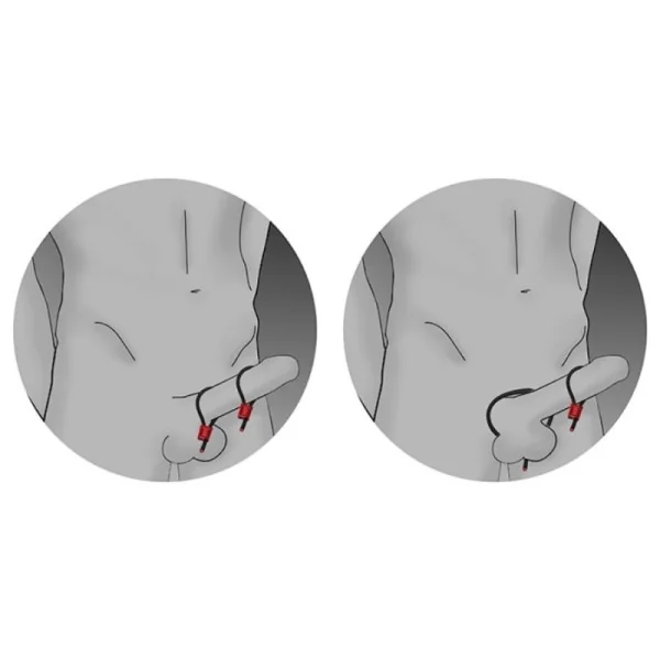 PRESTIGE ELECTRA LOOPS VERSTELLBARE COCKRINGE SCHWARZ VON ELECTRASTIM