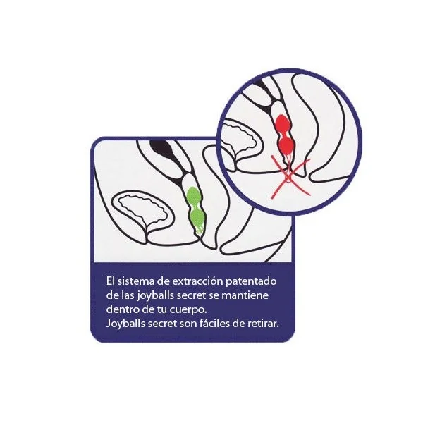 Geheime Schwarze und Rosa Chinesische Bälle von Joydivision Joyballs kaufen | Fesselliebe